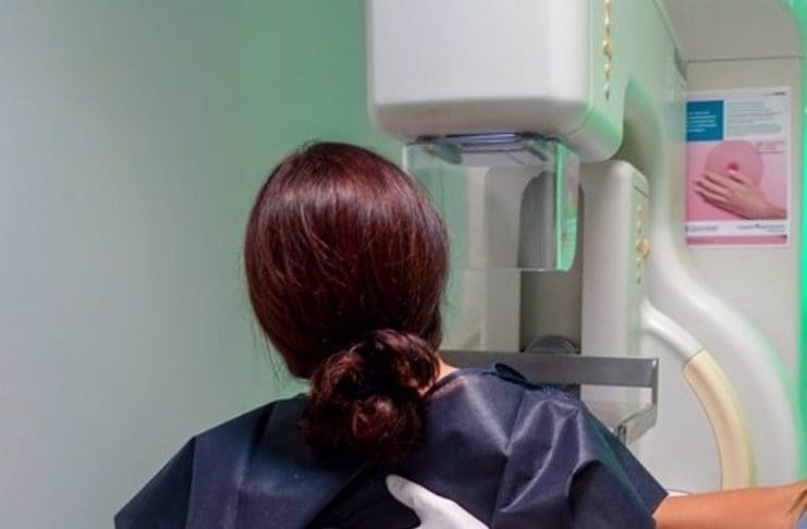 cáncer de mama