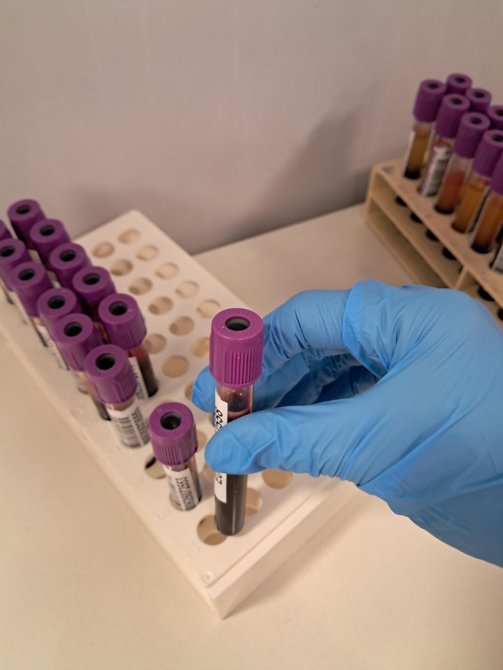 donaciones médula Comunitat valenciana